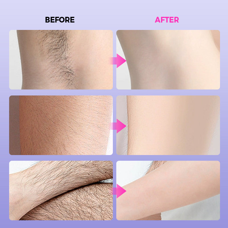 🥰Last Day: Buy 2 Get 1 Free!💥Multi-Use Gentle Effective Hair Removal Cream