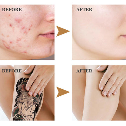 Two-tone Tattoo and Scar Cover-up Kit